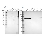 Anti-CCT5 antibody produced in rabbit Prestige Antibodies® Powered by Atlas Antibodies, affinity isolated antibody, buffered aqueous glycerol solution
