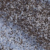 Anti-SLFN5 antibody produced in rabbit Prestige Antibodies® Powered by Atlas Antibodies, affinity isolated antibody, buffered aqueous glycerol solution