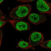 Anti-KLHL18 antibody produced in rabbit Prestige Antibodies® Powered by Atlas Antibodies, affinity isolated antibody, buffered aqueous glycerol solution