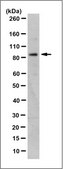 Anti-Nibrin/Nbs1 Antibody, clone EE15 (Ascites Free) clone EE15, from mouse
