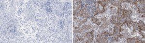 抗インテグリンαVβ5抗体 クローンEM09902 ZooMAb® ウサギ・モノクローナル recombinant, expressed in HEK 293 cells