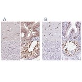 Anti-DR1 antibody produced in rabbit Prestige Antibodies® Powered by Atlas Antibodies, affinity isolated antibody, buffered aqueous glycerol solution