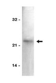 Anti-p21/WAF1/Cip1 Antibody Upstate®, from mouse