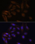 Anti-TFAP4 antibody produced in rabbit