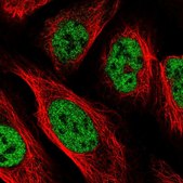 Anti-PPP4R2 antibody produced in rabbit Prestige Antibodies® Powered by Atlas Antibodies, affinity isolated antibody, buffered aqueous glycerol solution