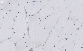 Anti-α-Dystroglycan Antibody, clone VIA4-1 ZooMAb® Mouse Monoclonal recombinant, expressed in HEK 293 cells