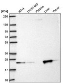 Anti-KBTBD8 antibody produced in rabbit Prestige Antibodies® Powered by Atlas Antibodies, affinity isolated antibody