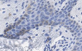Anti-MITF Antibody, clone 1E2 ZooMAb® Rabbit Monoclonal recombinant, expressed in HEK 293 cells