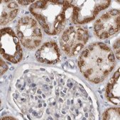 Anti-MRPL18 antibody produced in rabbit Prestige Antibodies® Powered by Atlas Antibodies, affinity isolated antibody, buffered aqueous glycerol solution, ab1