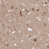 Anti-OPTN antibody produced in rabbit Ab1, Prestige Antibodies® Powered by Atlas Antibodies, affinity isolated antibody, buffered aqueous glycerol solution