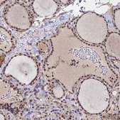 Anti-FKBPL antibody produced in rabbit Prestige Antibodies® Powered by Atlas Antibodies, affinity isolated antibody, buffered aqueous glycerol solution