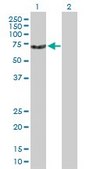 Anti-DKC1 antibody produced in mouse purified immunoglobulin, buffered aqueous solution