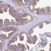 Anti-CLTA antibody produced in rabbit Prestige Antibodies® Powered by Atlas Antibodies, affinity isolated antibody, buffered aqueous glycerol solution