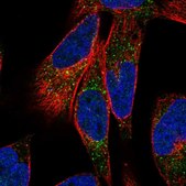 Anti-LTK antibody produced in rabbit Prestige Antibodies® Powered by Atlas Antibodies, affinity isolated antibody, buffered aqueous glycerol solution