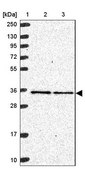 Anti-MRPL4 antibody produced in rabbit Prestige Antibodies® Powered by Atlas Antibodies, affinity isolated antibody, buffered aqueous glycerol solution
