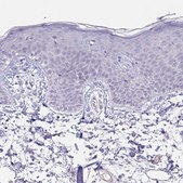 Anti-PYGM antibody produced in rabbit Prestige Antibodies® Powered by Atlas Antibodies, affinity isolated antibody, buffered aqueous glycerol solution