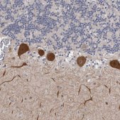 Anti-DLG2 antibody produced in rabbit Prestige Antibodies® Powered by Atlas Antibodies, affinity isolated antibody, buffered aqueous glycerol solution
