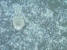 MB49 Mouse Bladder Carcinoma Cell Line MB49 mouse urothelial carcinoma cell line is widely used as an in vitro and in vivo model of bladder cancer.