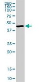 Anti-BDH1 antibody produced in rabbit purified immunoglobulin, buffered aqueous solution