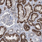 Anti-VPS13A antibody produced in rabbit Prestige Antibodies® Powered by Atlas Antibodies, affinity isolated antibody, buffered aqueous glycerol solution, Ab2