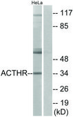 Anti-ACTHR antibody produced in rabbit affinity isolated antibody