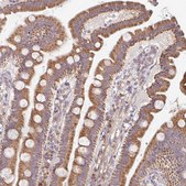 Anti-SKP2 antibody produced in rabbit Prestige Antibodies® Powered by Atlas Antibodies, affinity isolated antibody, buffered aqueous glycerol solution