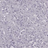 Anti-CST7 antibody produced in rabbit Prestige Antibodies® Powered by Atlas Antibodies, affinity isolated antibody, buffered aqueous glycerol solution
