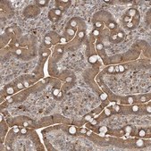 Anti-TRAIP antibody produced in rabbit Prestige Antibodies® Powered by Atlas Antibodies, affinity isolated antibody, buffered aqueous glycerol solution