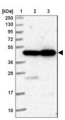 Anti-ELAC1 antibody produced in rabbit Prestige Antibodies® Powered by Atlas Antibodies, affinity isolated antibody, buffered aqueous glycerol solution