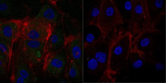 Anti-phospho-VE-Cadherin (Tyr685) Antibody, Alexa Fluor&#8482; 488 Conjugate from rabbit, ALEXA FLUOR&#8482; 488