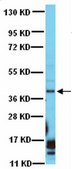 Anti-DAPK2 Antibody from rabbit, purified by affinity chromatography