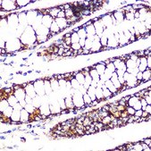 Anti-DLDH/DLD antibody produced in rabbit