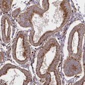 Anti-WASF2 antibody produced in rabbit Prestige Antibodies® Powered by Atlas Antibodies, affinity isolated antibody, buffered aqueous glycerol solution