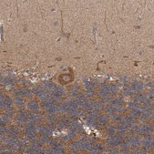 Anti-TRIM16 antibody produced in rabbit Prestige Antibodies® Powered by Atlas Antibodies, affinity isolated antibody, buffered aqueous glycerol solution