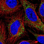 Anti-COL5A1 antibody produced in rabbit Prestige Antibodies® Powered by Atlas Antibodies, affinity isolated antibody, buffered aqueous glycerol solution