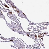 Anti-ARHGEF18 antibody produced in rabbit Prestige Antibodies® Powered by Atlas Antibodies, affinity isolated antibody, buffered aqueous glycerol solution