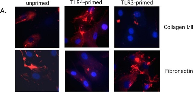 Anti-Collagen Type I Antibody, clone 5D8-G9 clone 5D8-G9, Chemicon&#174;, from mouse