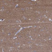 Anti-PRRT3 antibody produced in rabbit Prestige Antibodies® Powered by Atlas Antibodies, affinity isolated antibody, buffered aqueous glycerol solution
