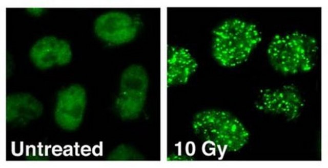 Anticuerpo anti-53BP1, clon BP13 clone BP13, Chemicon&#174;, from mouse