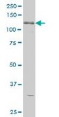 Monoclonal Anti-ABL2 antibody produced in mouse clone 5C6, purified immunoglobulin, buffered aqueous solution