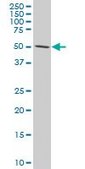 Monoclonal Anti-TCF7L2 antibody produced in mouse clone 1A1, purified immunoglobulin, buffered aqueous solution