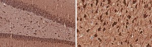 Anti-MAP2 Antibody, clone 3C19, ZooMAb® Rabbit Monoclonal recombinant, expressed in HEK 293 cells