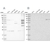 Anti-PKP1 antibody produced in rabbit Prestige Antibodies® Powered by Atlas Antibodies, affinity isolated antibody, buffered aqueous glycerol solution, ab1
