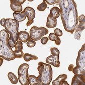 Anti-CDK16 antibody produced in rabbit Prestige Antibodies® Powered by Atlas Antibodies, affinity isolated antibody, buffered aqueous glycerol solution