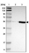 Anti-ZNF165 antibody produced in rabbit Prestige Antibodies® Powered by Atlas Antibodies, affinity isolated antibody, buffered aqueous glycerol solution
