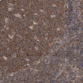 Anti-DDX6 antibody produced in rabbit Prestige Antibodies® Powered by Atlas Antibodies, affinity isolated antibody, buffered aqueous glycerol solution