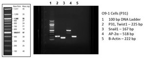 O9-1 Mouse Cranial Neural Crest Cell Line stably expresses stem cell markers and neural crest markers