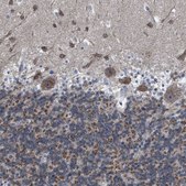 Anti-DDX56 antibody produced in rabbit Prestige Antibodies® Powered by Atlas Antibodies, affinity isolated antibody, buffered aqueous glycerol solution