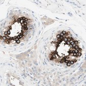 Anti-ART3 antibody produced in rabbit Prestige Antibodies® Powered by Atlas Antibodies, affinity isolated antibody, buffered aqueous glycerol solution