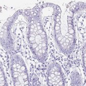 Anti-TNNT1 antibody produced in rabbit Prestige Antibodies® Powered by Atlas Antibodies, affinity isolated antibody, buffered aqueous glycerol solution